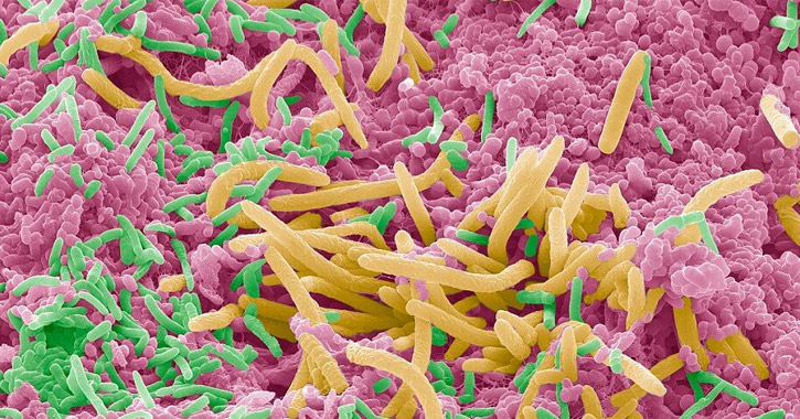 Sokkoló közeli képek a szánkban tanyázó baktériumokról